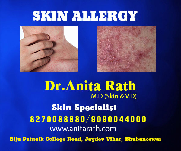 Best skin treatment clinic in bhubaneswar near aditya care hospital